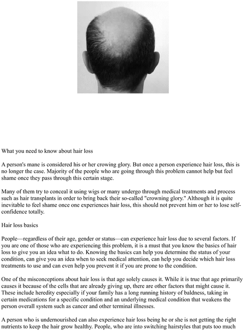 Product picture What you need to know about hair loss pdf